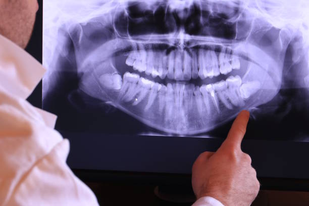 Best Emergency Dental Care for Broken or Chipped Teeth in New Martinsville, WV