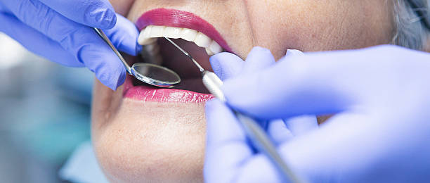 Best Emergency Tooth Extraction in New Martinsville, WV